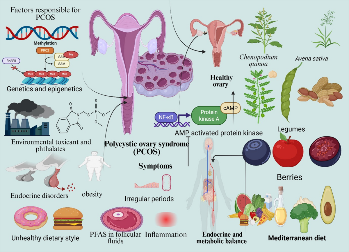 Polycystic Ovary Syndrome (PCOS): A Comprehensive Review of Clinical  Approaches, Functional Bioactives, and Nutritional Interventions |  Reproductive Sciences