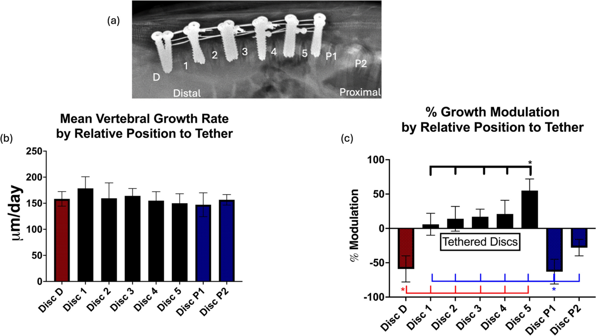 Physeal effects of posterior VBT are not uniform throughout a multi-tether  construct in the kyphotic swine model | Spine Deformity | Springer Nature  Link