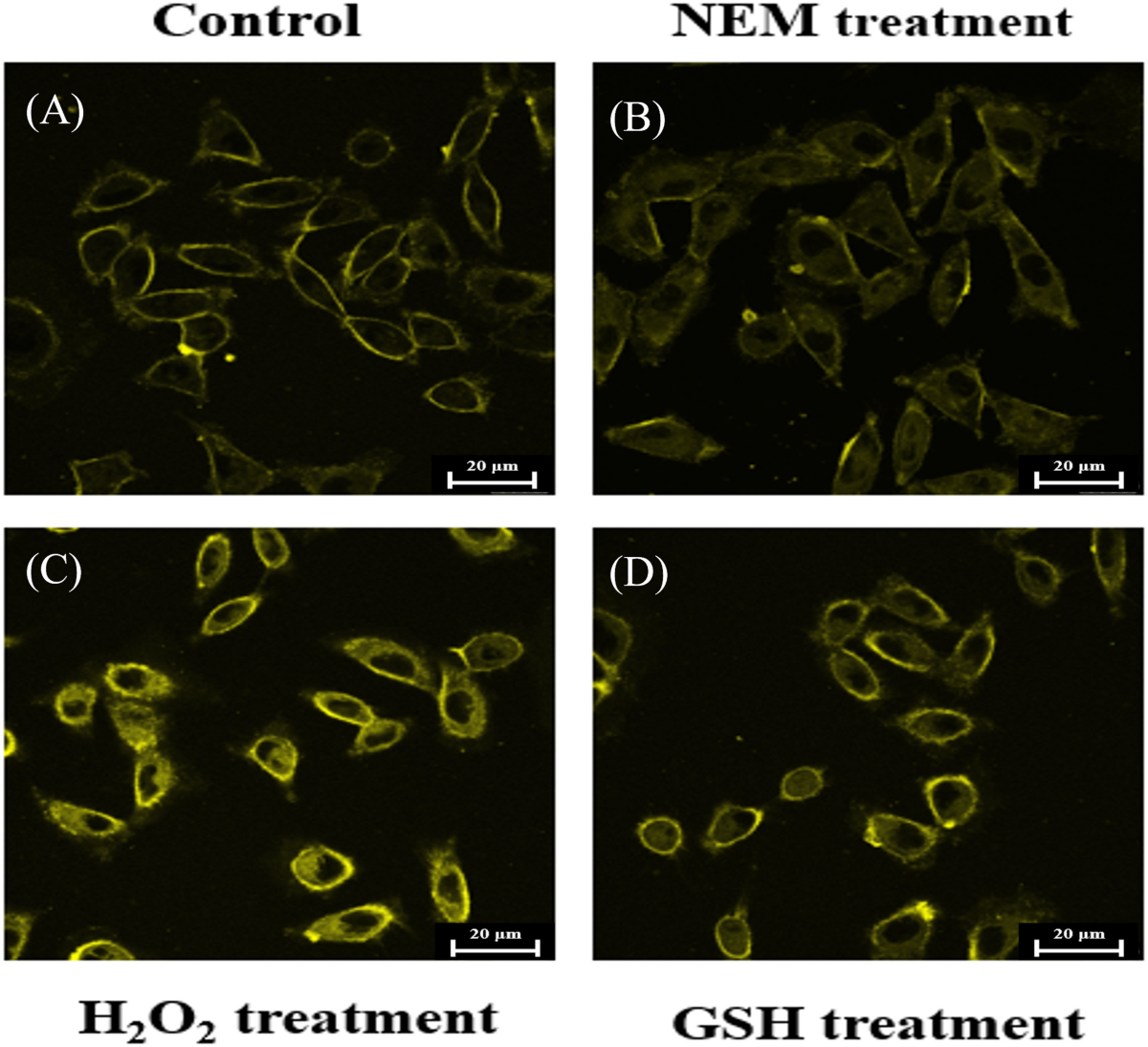 Observation of glutathione intra- and extracellular membrane with large Stokes shift probe modified by long alkyl chains | Photochemical & Photobiological Sciences