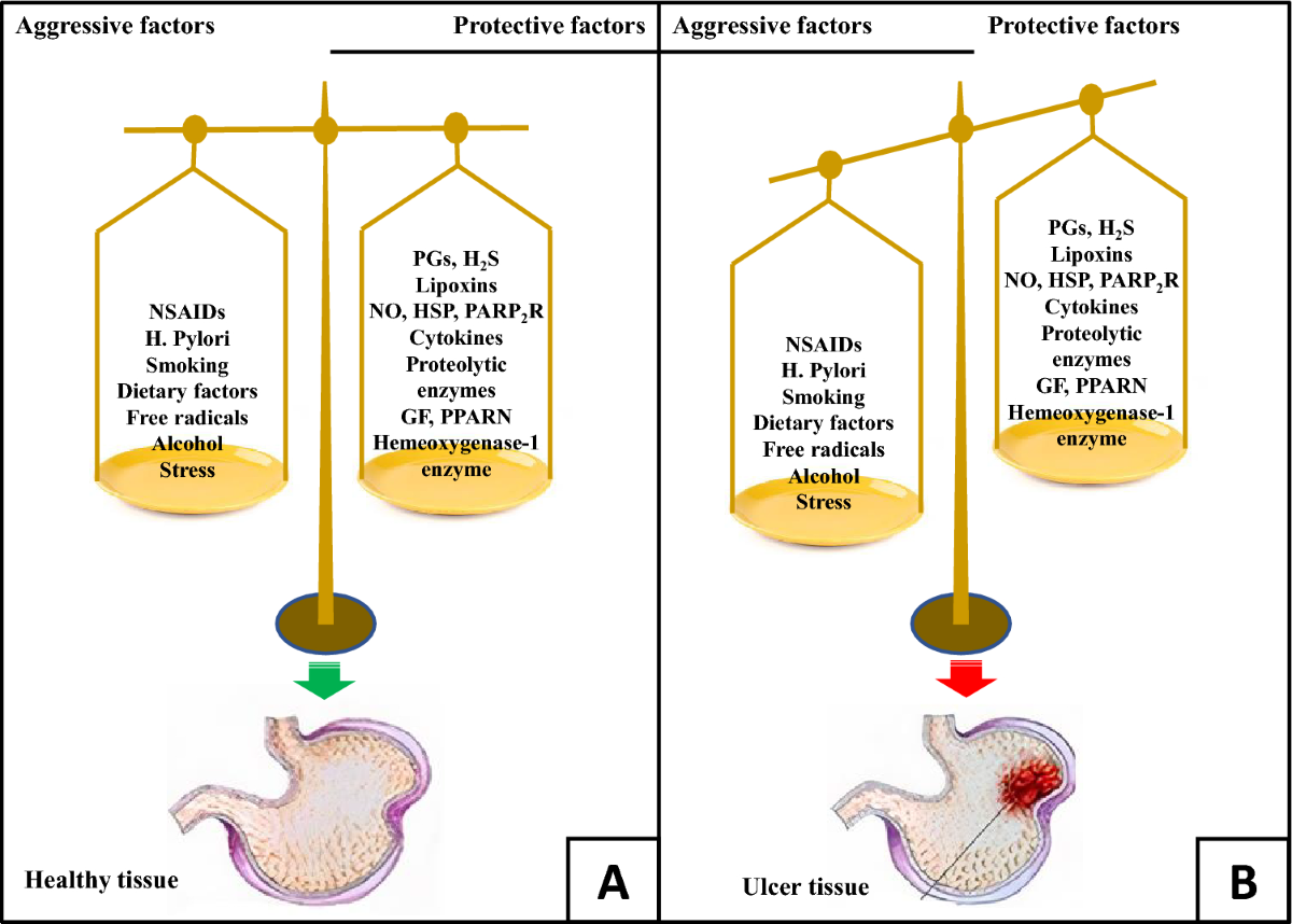 is glutathione good for stomach ulcers A comprehensive review on phytochemicals as potential therapeutic agents  for stress-induced gastric ulcer | Journal of Umm Al-Qura University for  Applied Sciences