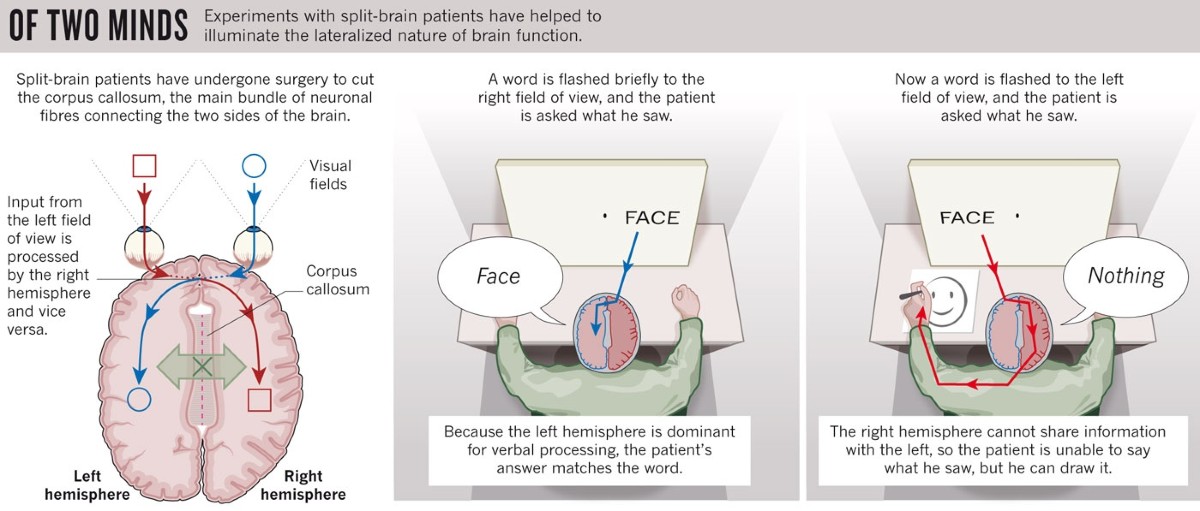 The split brain: A tale of two halves | Nature