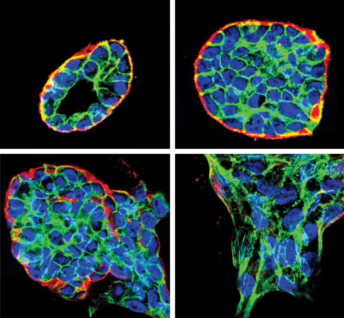 Mechanics: The forces of cancer | Nature