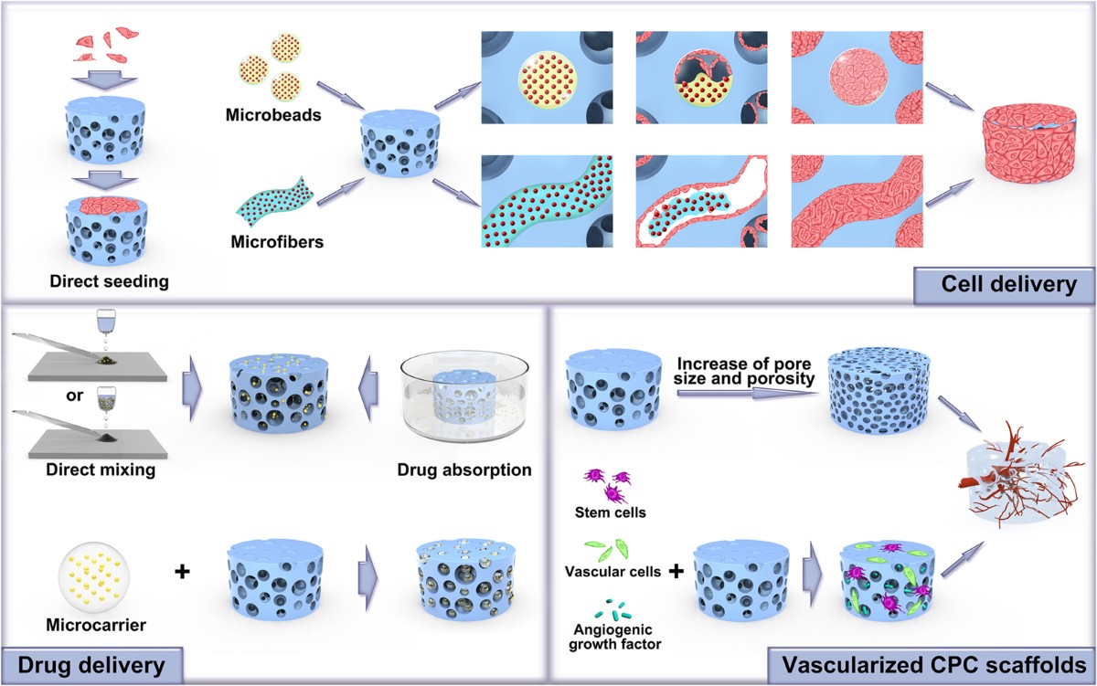 Calcium phosphate cements for bone engineering and their biological  properties | Bone Research