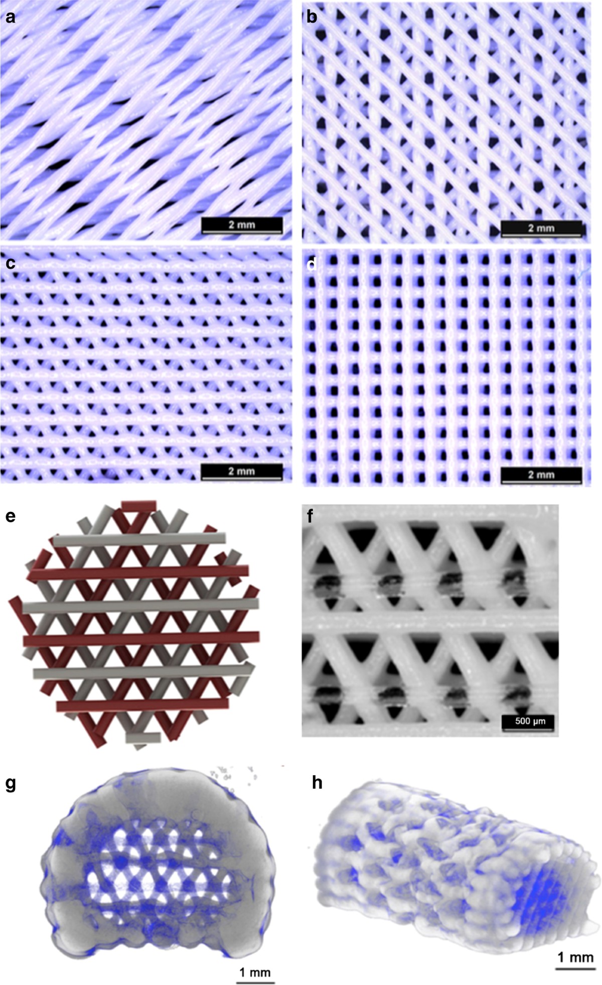 Calcium phosphate cements for bone engineering and their biological  properties | Bone Research