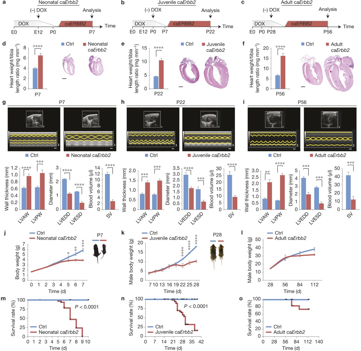 ERBB2 triggers mammalian heart regeneration by promoting cardiomyocyte  dedifferentiation and proliferation | Nature Cell Biology