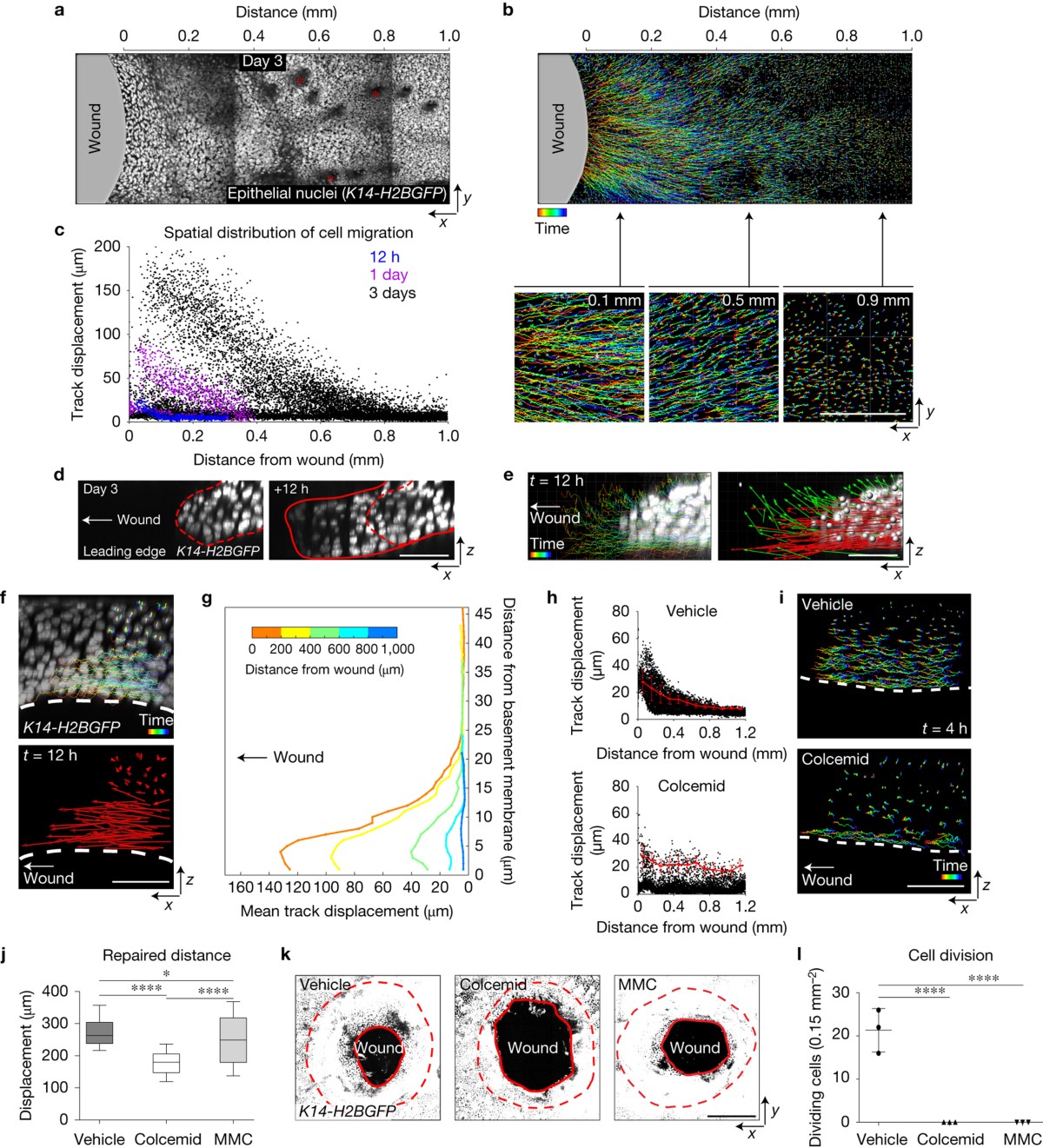 Tissue-scale coordination of cellular behaviour promotes epidermal wound  repair in live mice