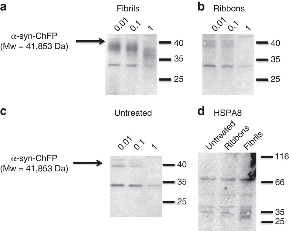 Structural and functional characterization of two alpha-synuclein strains | Nature Communications structural-and-functional-characterization-of-two-alpha-synuclein-strains-nature-communications