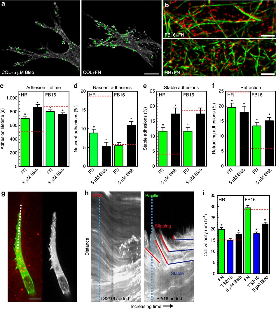 Local 3D matrix microenvironment regulates cell migration through  spatiotemporal dynamics of contractility-dependent adhesions