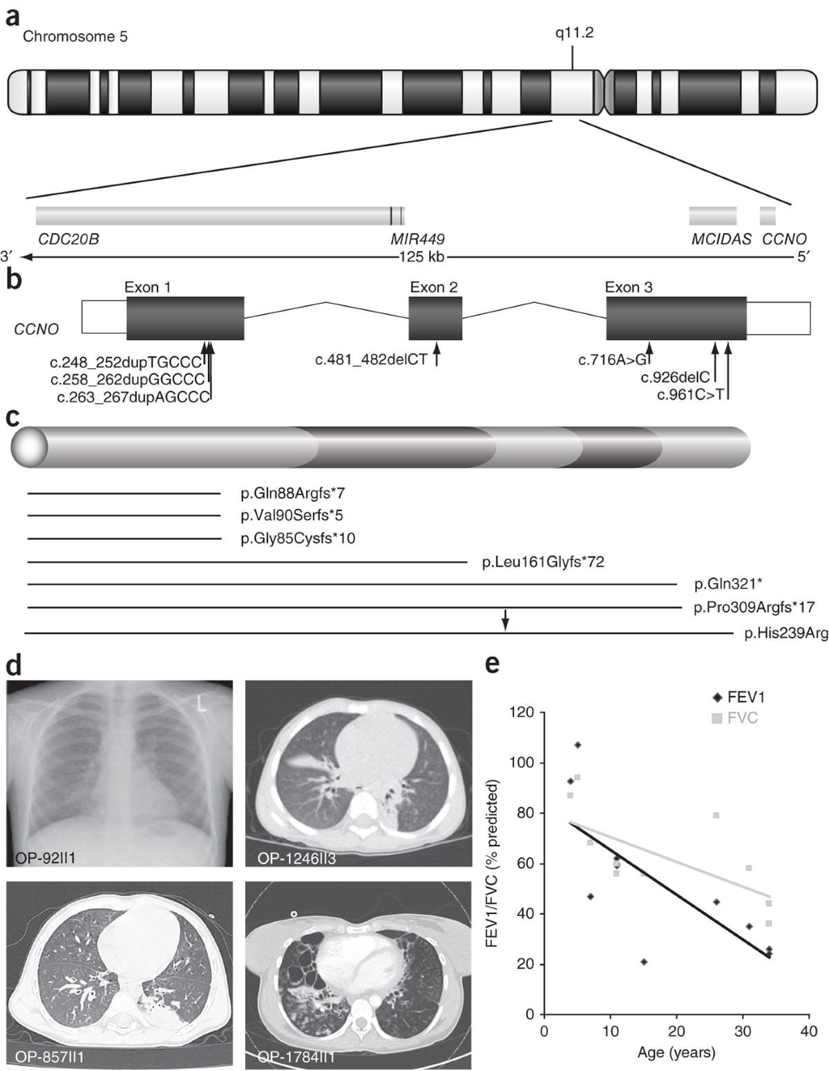 Mutations in CCNO result in congenital mucociliary clearance disorder with  reduced generation of multiple motile cilia | Nature Genetics