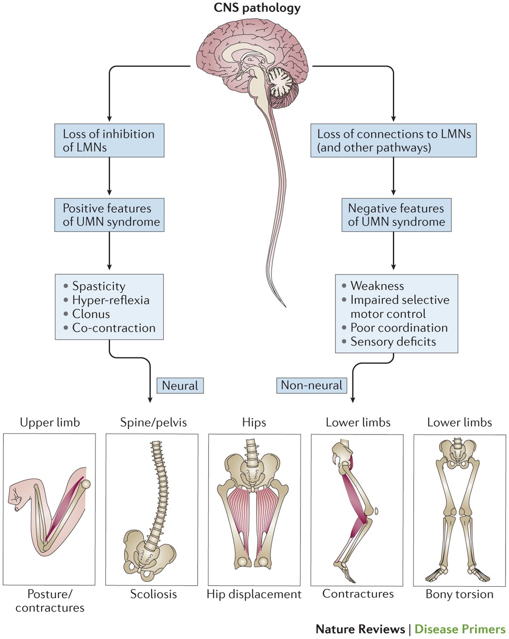 The pathogenesis of Cerebral Palsy (CP) is driven by damage or dysfunction in various brain cells that play vital roles in motor control, coordination, and neurological development. Here are the primary cells affected: