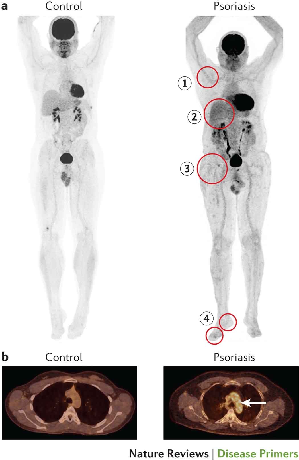Frontiers | A Genome-Wide Integrative Association Study of DNA Methylation  and Gene Expression Data and Later Life Cognitive Functioning in  Monozygotic Twins, image size:1050x1613