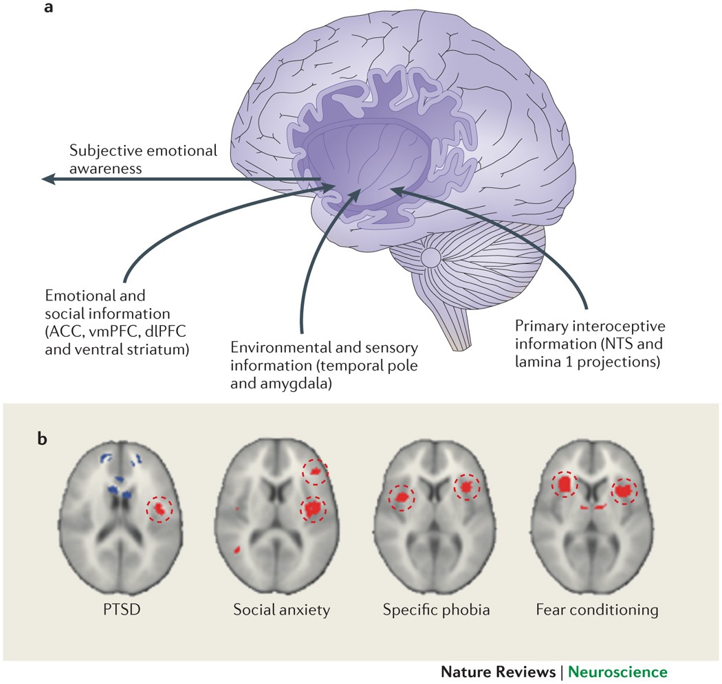 Anticipatory Anxiety