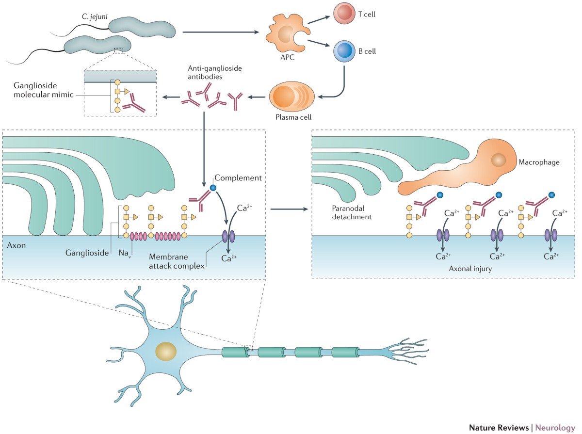 guillain barre syndrome and glutathione Guillain–Barré syndrome: a century of progress guillain barre pathophysiology