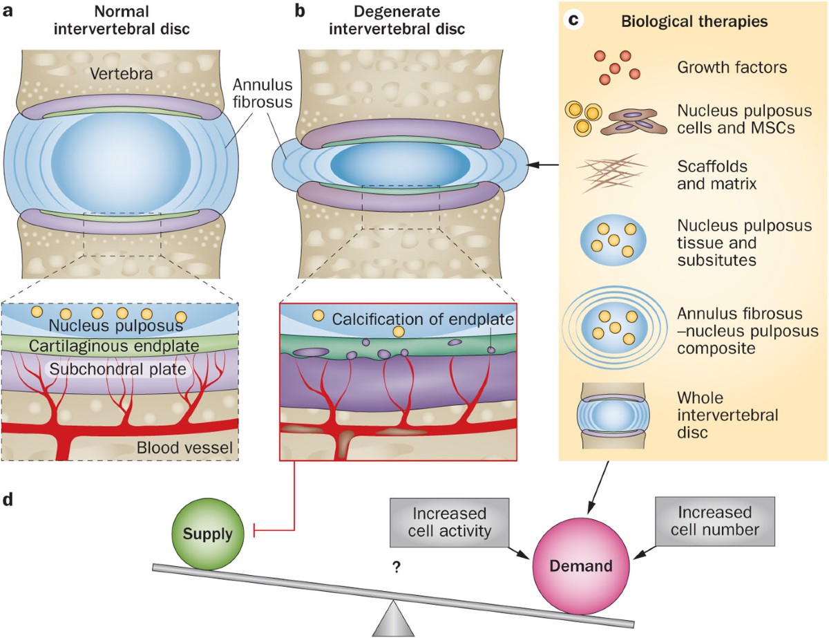 bpc-157 tissue repair benefits In our latest blog, we break down how BPC-157 and KPV peptides work  together to support healing, recovery, and inflammation. BPC-157 helps  repair damaged tissue while KPV reduces the inflammation causing the