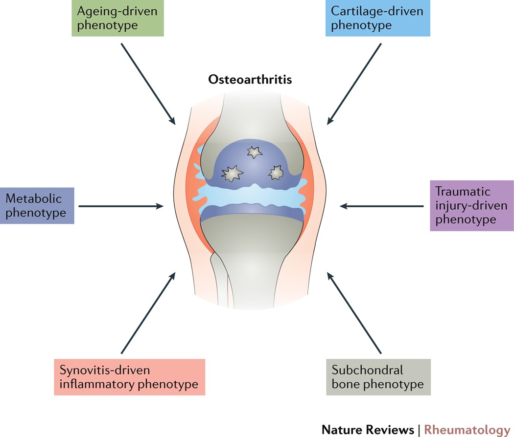glutathione osteoarthritis The role of metabolism in the pathogenesis of osteoarthritis
