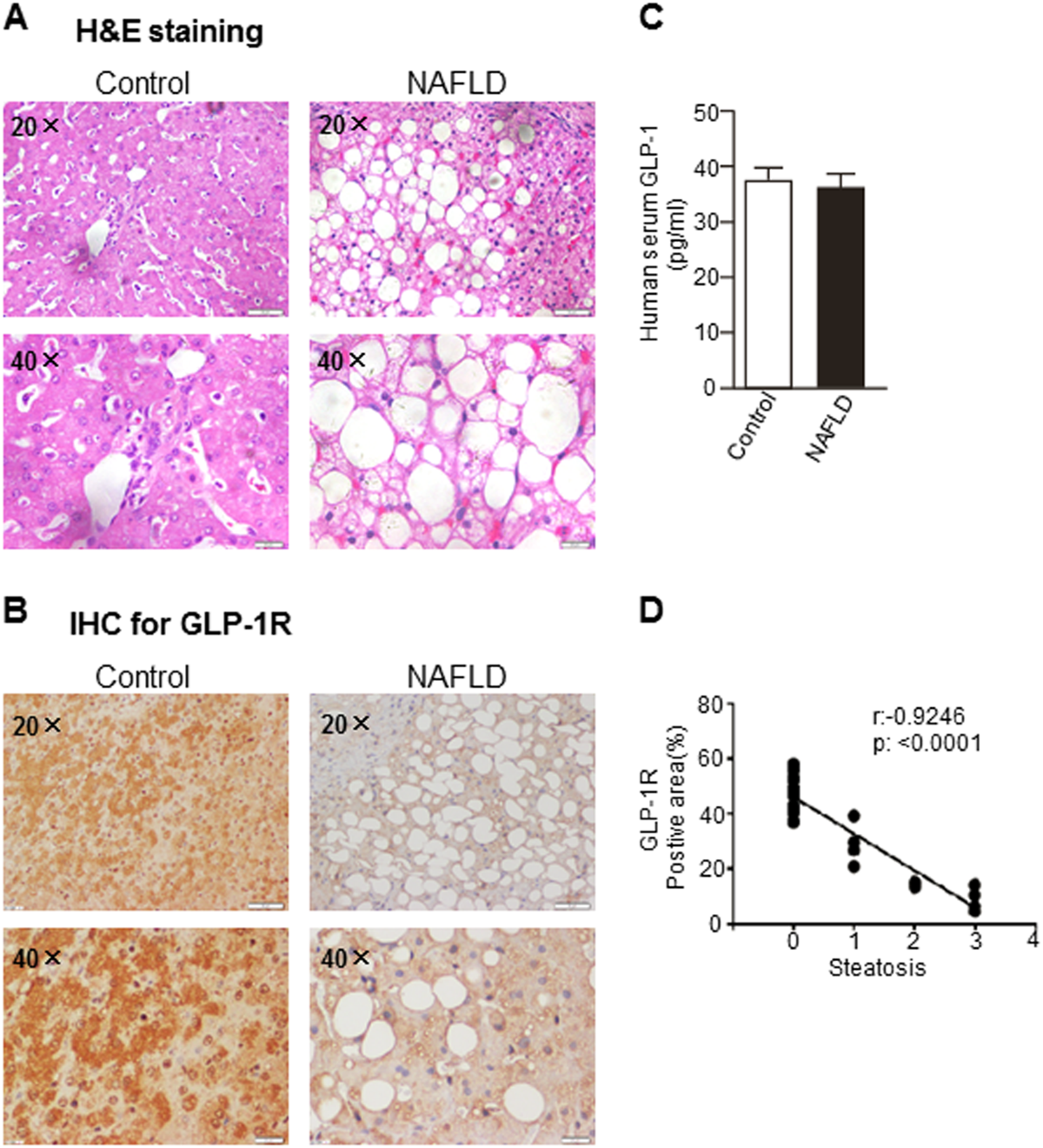 glp-1 for fatty liver Sodium butyrate reduces high-fat diet-induced non-alcoholic steatohepatitis  through upregulation of hepatic GLP-1R expression