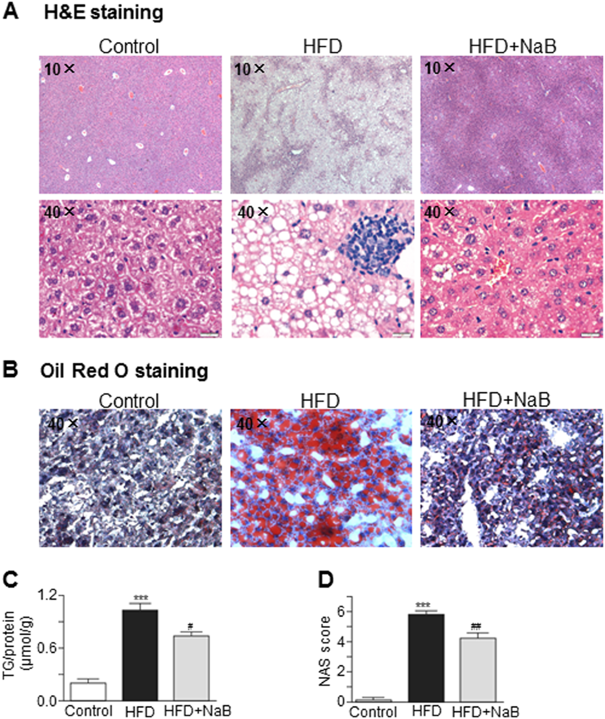 glp-1 and no gallbladder GLP-1s And Gallbladder Issues: Safe If You've Had It Removed?