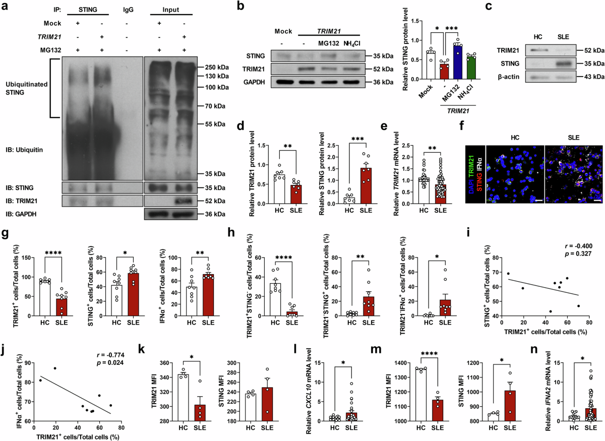 The ubiquitin E3 ligase TRIM21 suppresses type I interferon signaling via  STING degradation and ameliorates systemic autoimmunity | Experimental &  Molecular Medicine
