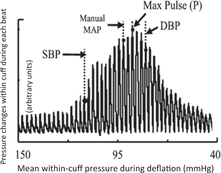 Oscillometric measurement of blood pressure: a simplified explanation. A  technical note on behalf of the British and Irish Hypertension Society |  Journal of Human Hypertension