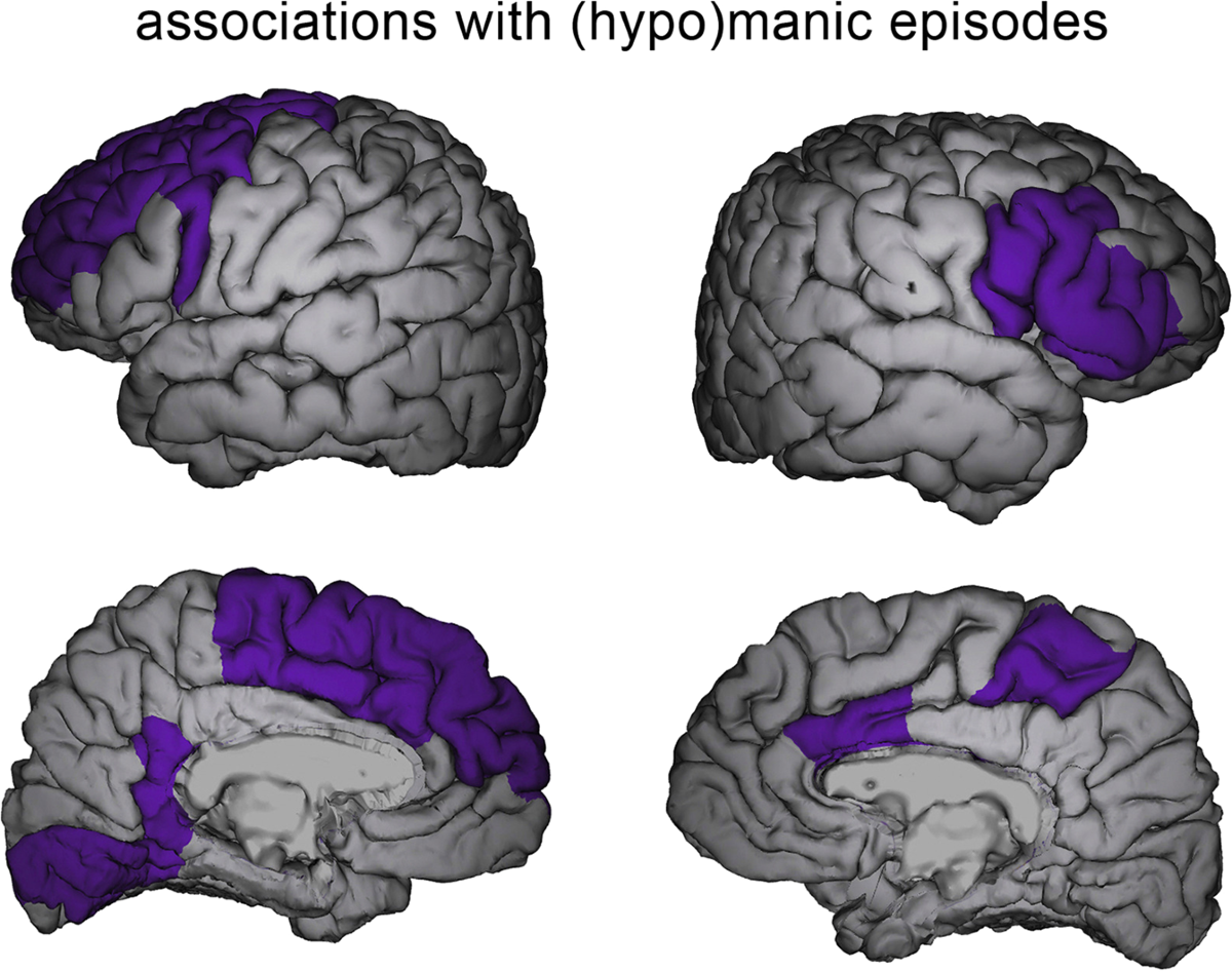 l-carnitine can cause manic behavior in patients with bipolar disorder Mania-related effects on structural brain changes – a narrative review of the evidence Why Nasal Glutathione Works Moisturizing toner for glowing skin Lot #:Lot #: N9DSIP10/0729