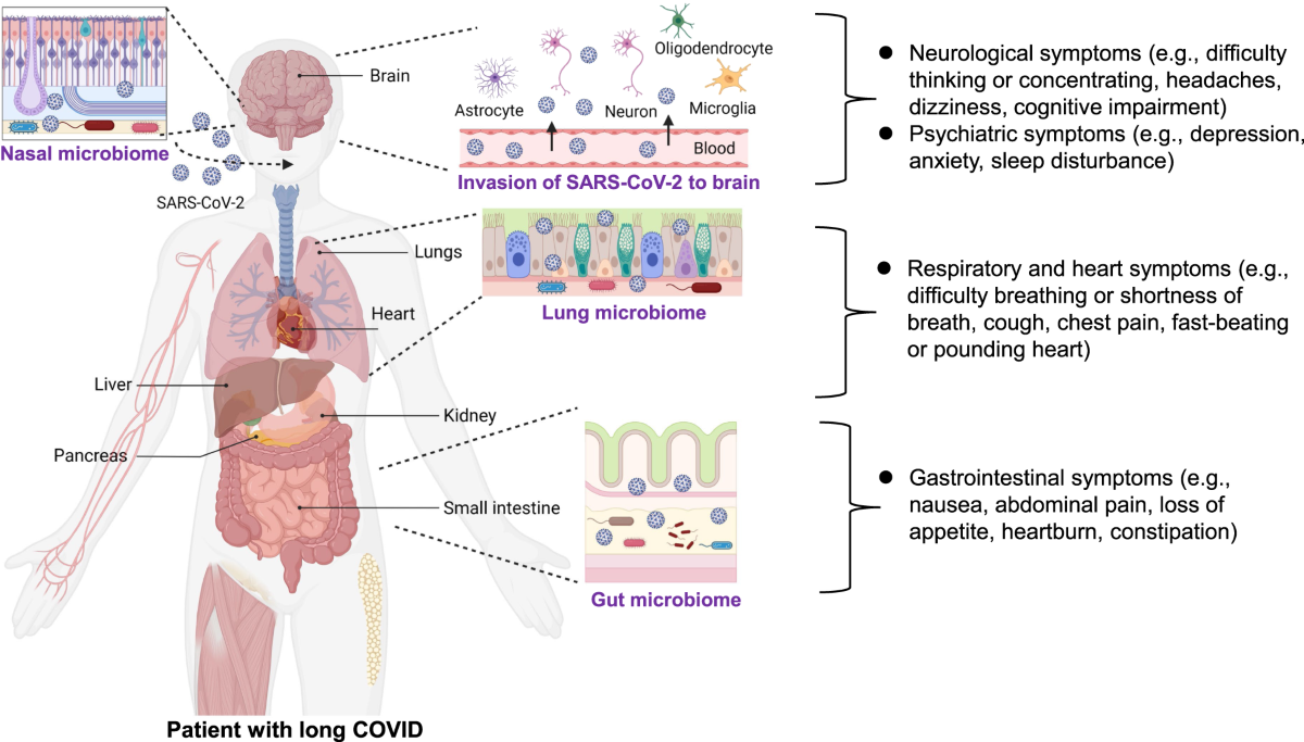 Detrimental effects of COVID-19 in the brain and therapeutic options for  long COVID: The role of Epstein–Barr virus and the gut–brain axis |  Molecular Psychiatry