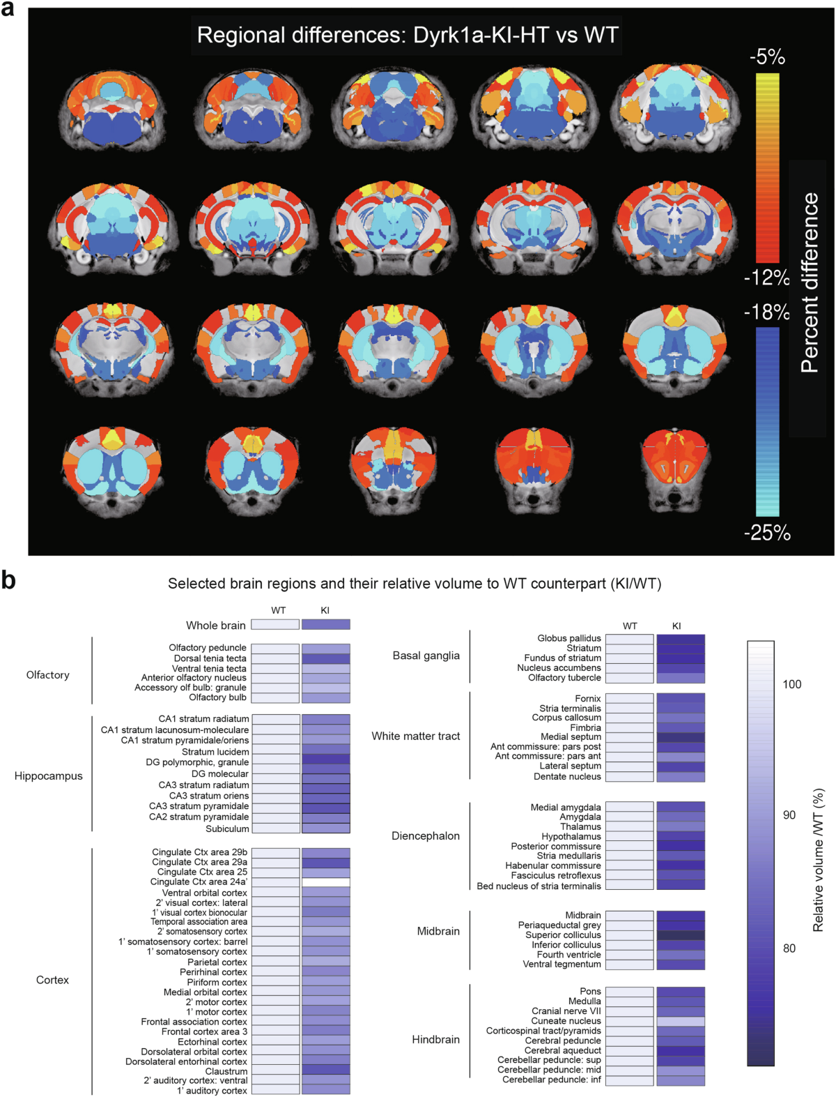 Lithium normalizes ASD-related neuronal, synaptic, and behavioral  phenotypes in DYRK1A-knockin mice | Molecular Psychiatry