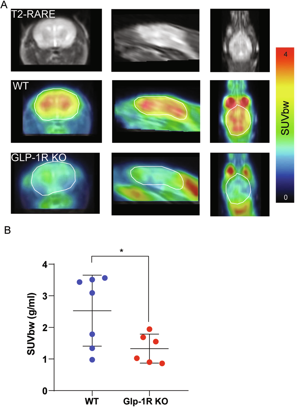 glp 1 and pet scan Impaired brain glucose metabolism in glucagon-like peptide-1 receptor  knockout mice