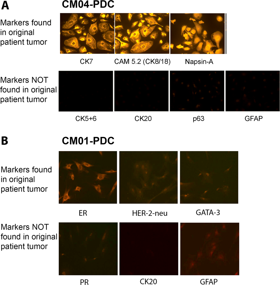 Isolation and characterization of patient-derived CNS metastasis-associated  stromal cell lines | Oncogene