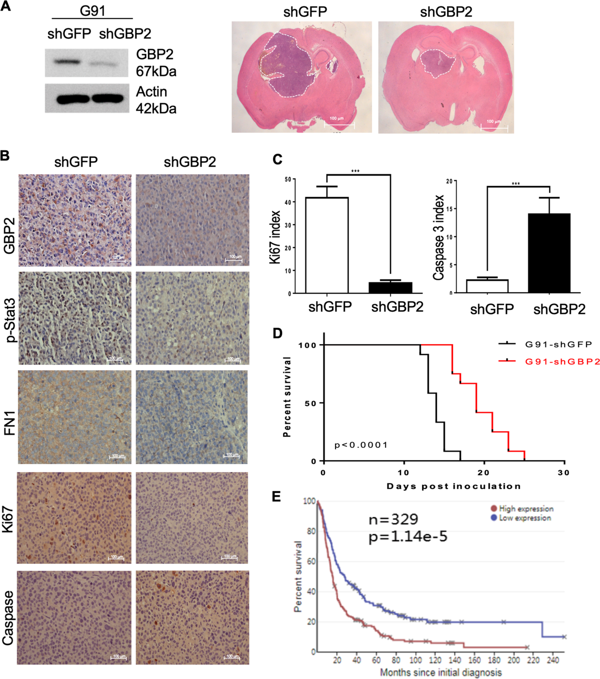 GBP2 enhances glioblastoma invasion through Stat3/fibronectin pathway |  Oncogene