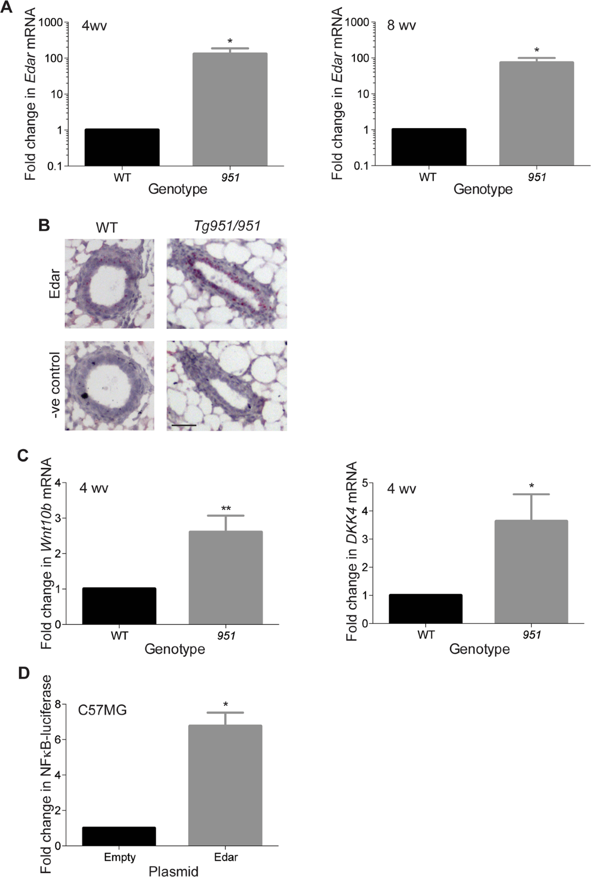 Elevated EDAR signalling promotes mammary gland tumourigenesis with  squamous metaplasia | Oncogene
