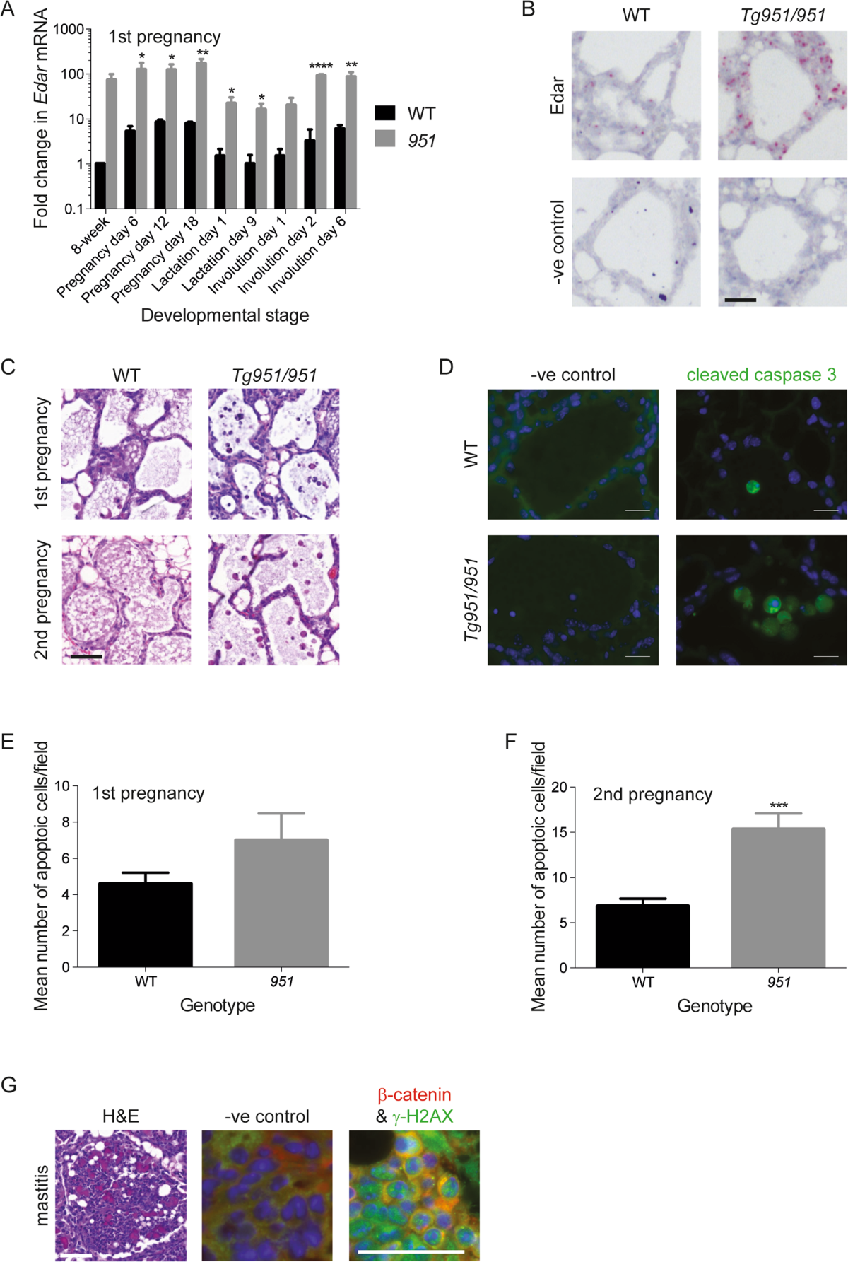 Elevated EDAR signalling promotes mammary gland tumourigenesis with  squamous metaplasia | Oncogene