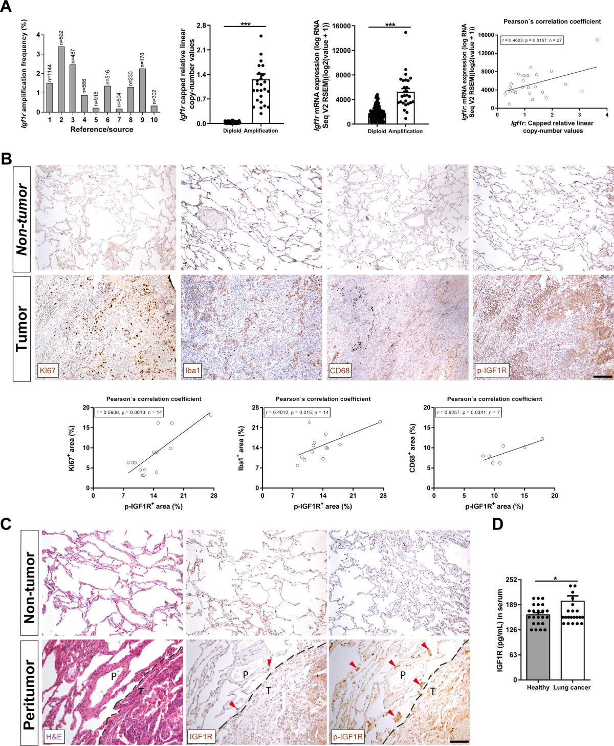 igf 1 lr3 cancer reddit IGF1R acts as a cancer-promoting factor in the tumor microenvironment facilitating lung metastasis implantation and progression Mg:50 mg كريم يحد من تراكم الميلانين DSIP - Research Peptide