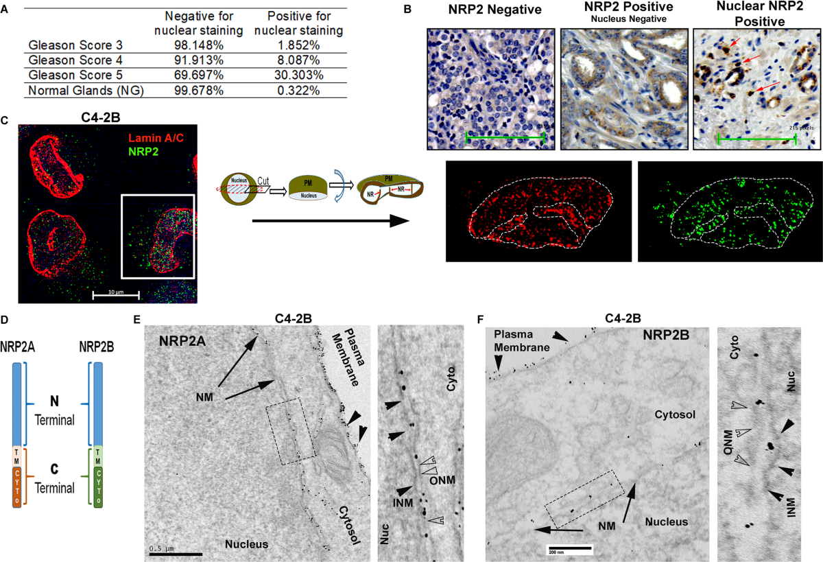 Ls- nude lsm 02 Neuropilin-2 regulates androgen-receptor transcriptional activity in  advanced prostate cancer | Oncogene