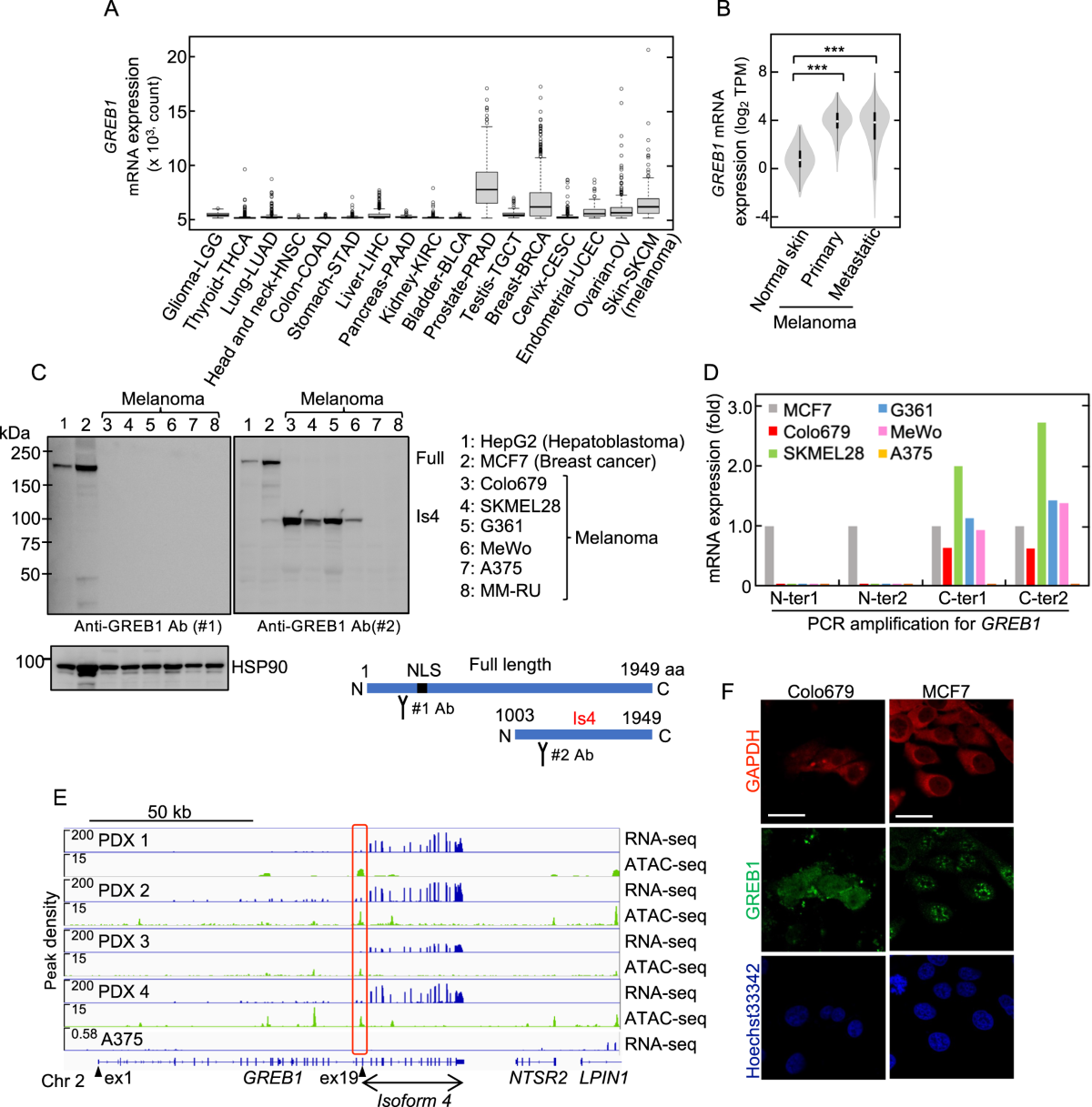 GREB1 isoform 4 is specifically transcribed by MITF and required  