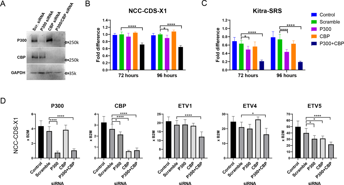 Inactivation of the CIC-DUX4 oncogene through P300/CBP inhibition, a therapeutic approach for CIC-DUX4 sarcoma | Oncogenesis inactivation-of-the-cic-dux4-oncogene-through-p300-cbp-inhibition-a-therapeutic-approach-for-cic-dux4-sarcoma-oncogenesis