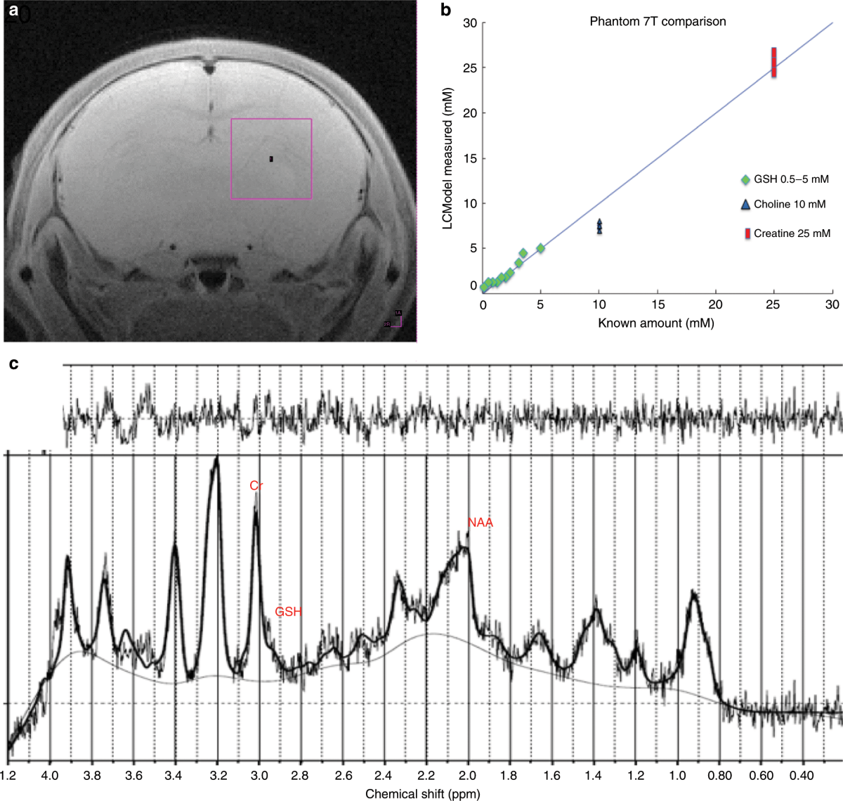 glutathione withdrawal symptoms N-acetylcysteine mitigates acute opioid withdrawal behaviors and CNS  oxidative stress in neonatal rats
