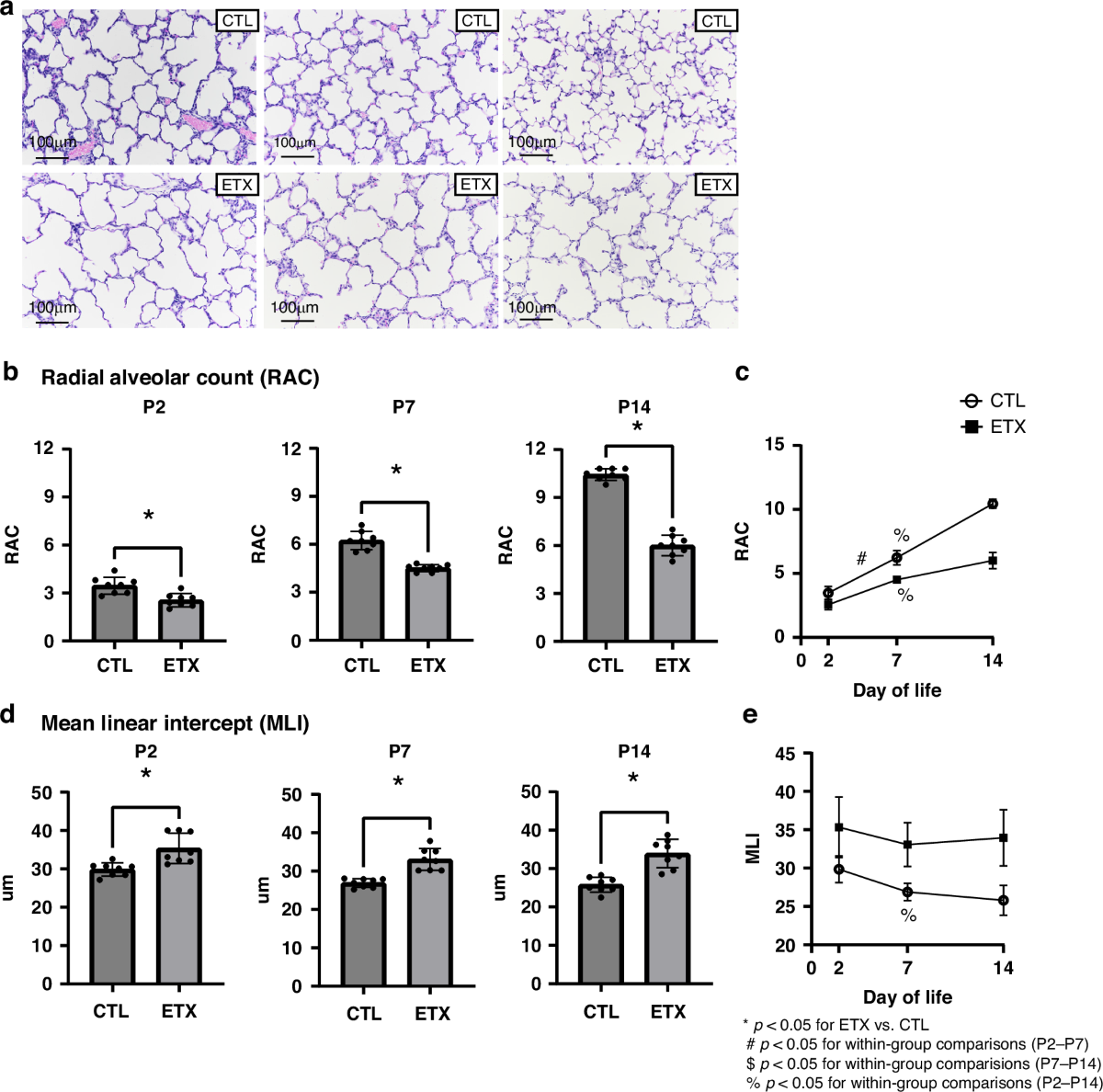 Development of late pulmonary hypertension after antenatal inflammation in  experimental bronchopulmonary dysplasia | Pediatric Research