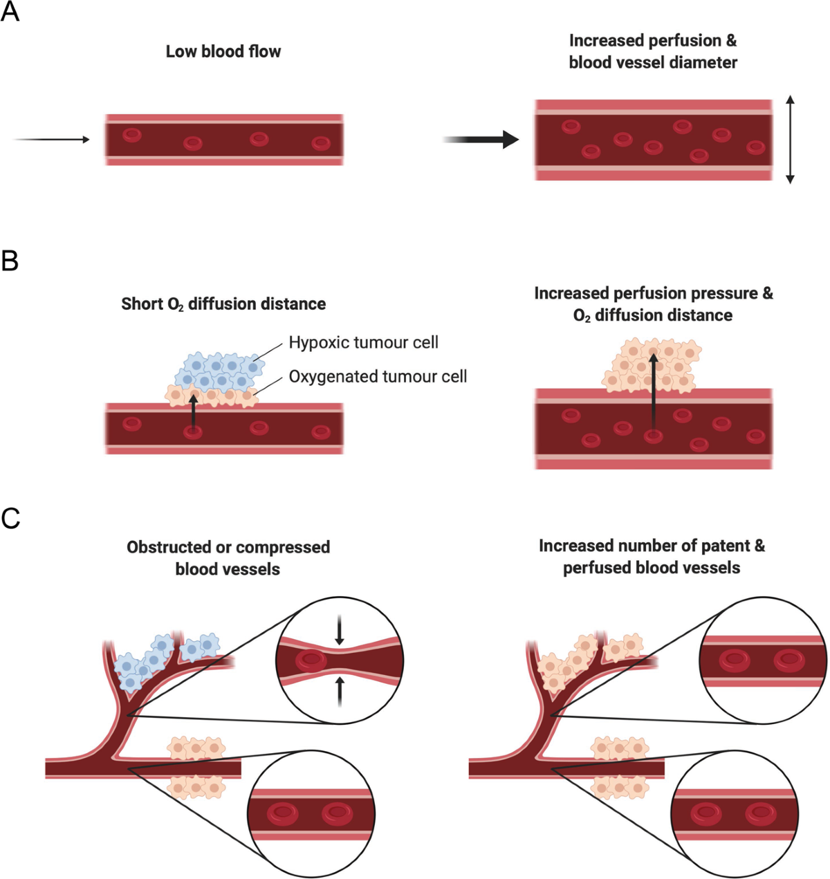 Exercise modulation of tumour perfusion and hypoxia to improve radiotherapy  response in prostate cancer | Prostate Cancer and Prostatic Diseases