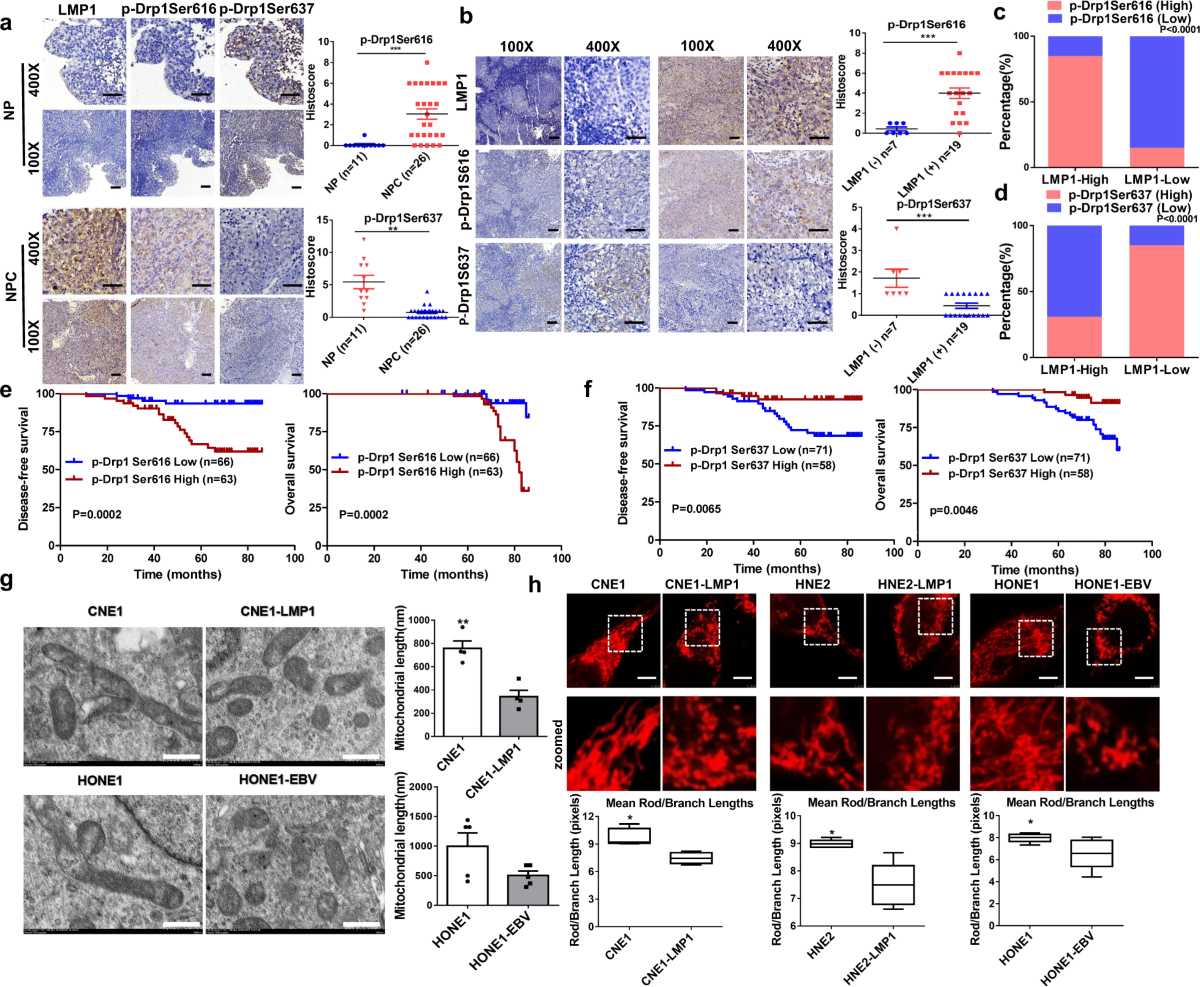  lsm nude ls-020 Salinomycin induces autophagic cell death in salinomycin-sensitive melanoma  cells through inhibition of autophagic flux | Scientific Reports
