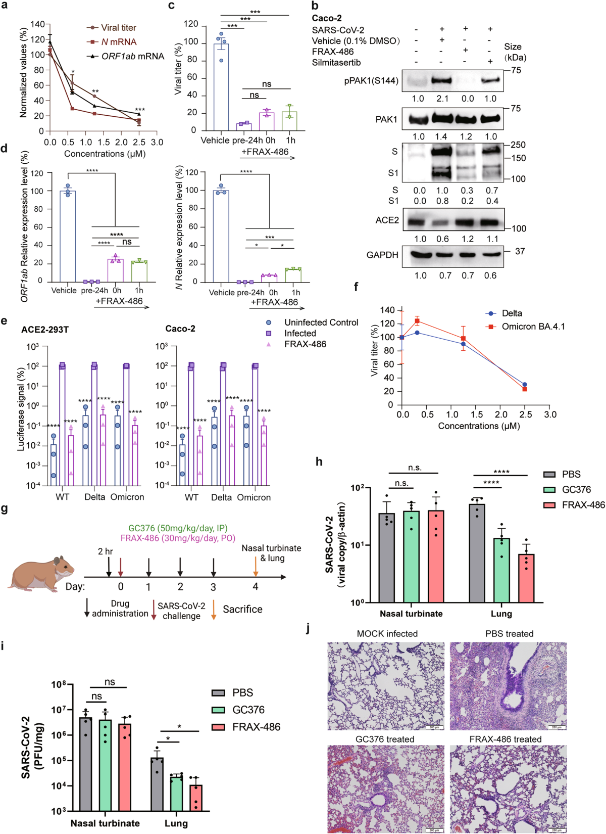 P21-activated kinase 1 (PAK1)-mediated cytoskeleton rearrangement promotes  SARS-CoV-2 entry and ACE2 autophagic degradation | Signal Transduction and  Targeted Therapy