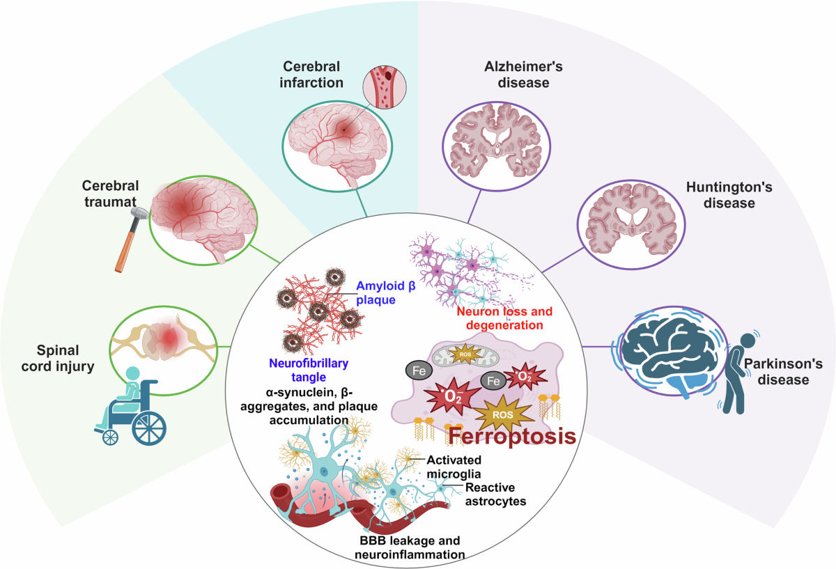 iv glutathione for iron overload Iron homeostasis and ferroptosis in human diseases: mechanisms and  therapeutic prospects