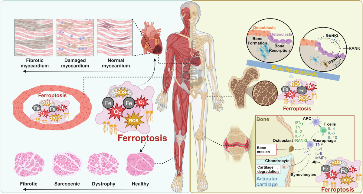 glutathione mitochondrial function Glycine and N-acetylcysteine (NAC) are amino acid–based nutrients that  serve as precursors for glutathione, one of the body's most important  intracellular antioxidants. Glutathione plays a central role in reducing  oxidative stress, supporting