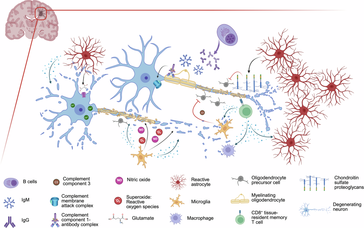 Multiple sclerosis: molecular pathogenesis and therapeutic intervention