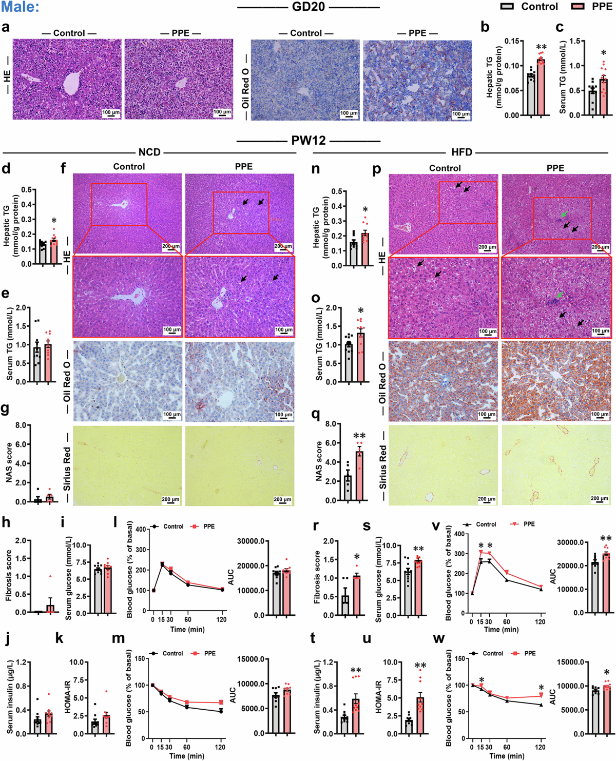 prednisone and semaglutide interactions Serpina3c protects against metabolic dysfunction-associated steatotic liver  disease in offspring induced by prenatal prednisone exposure