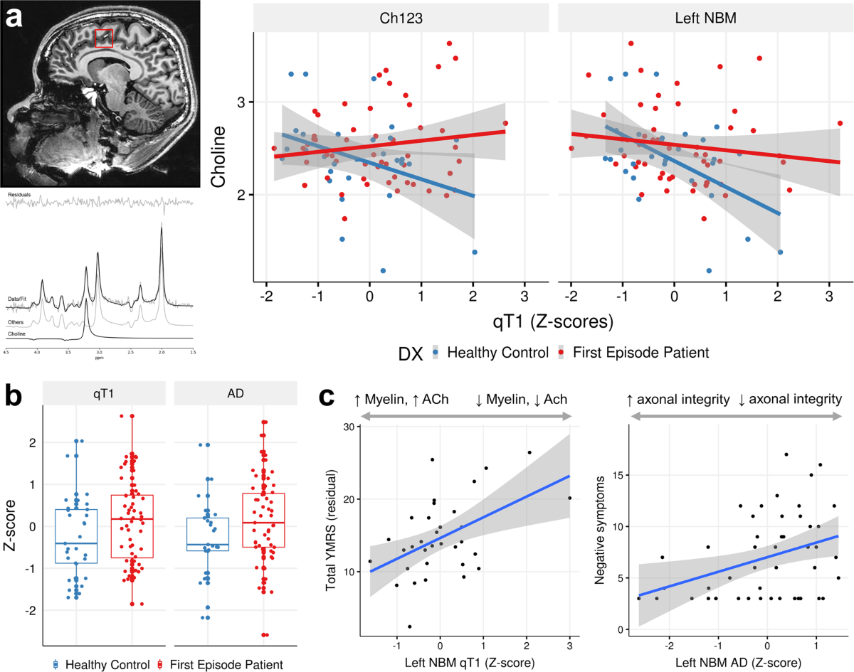 Microstructural imaging and transcriptomics of the basal forebrain in  first-episode psychosis | Translational Psychiatry