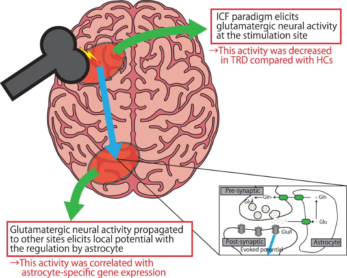 Decreased prefrontal glutamatergic function is associated with a reduced  astrocyte-related gene expression in treatment-resistant depression |  Translational Psychiatry