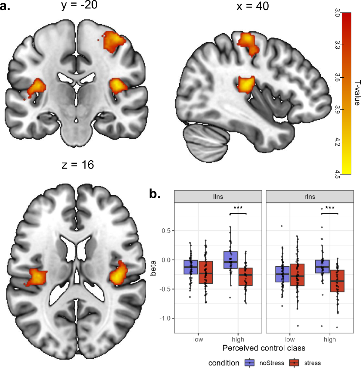 Perceived control as a resilience factor: associations with neural,  physiological and affective stress responses and mental health |  Translational Psychiatry