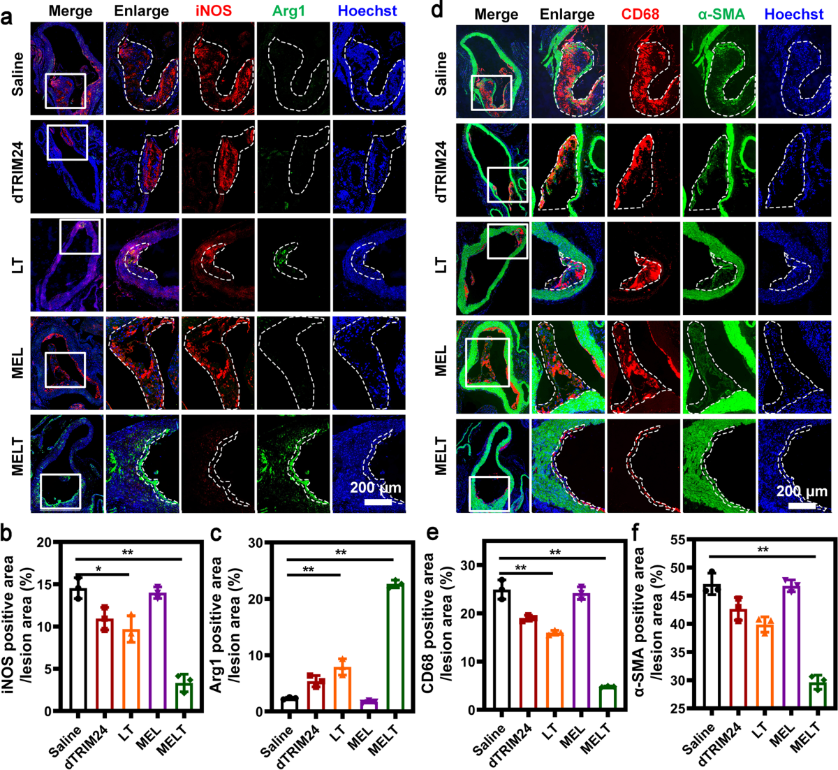 Bioinspired PROTAC-induced macrophage fate determination alleviates  atherosclerosis | Acta Pharmacologica Sinica