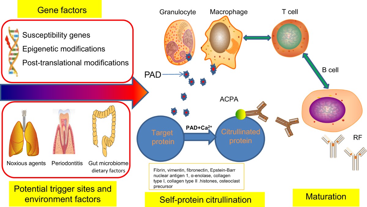 glutathione and rheumatoid arthritis Rheumatoid arthritis: pathological mechanisms and modern pharmacologic  therapies