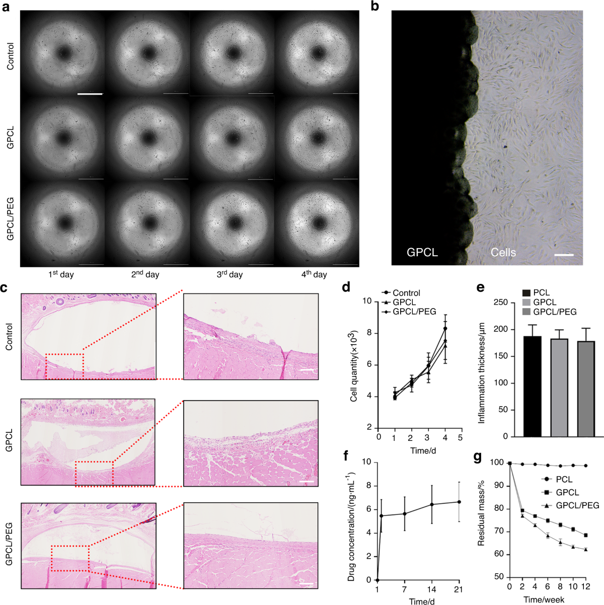 An injectable self-adaptive polymer as a drug carrier for the treatment of  nontraumatic early-stage osteonecrosis of the femoral head | Bone Research